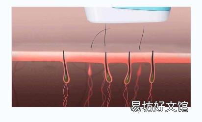 脱毛间隔多久一次 激光脱毛多长时间一次