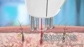 脱毛间隔多久一次 激光脱毛多长时间一次