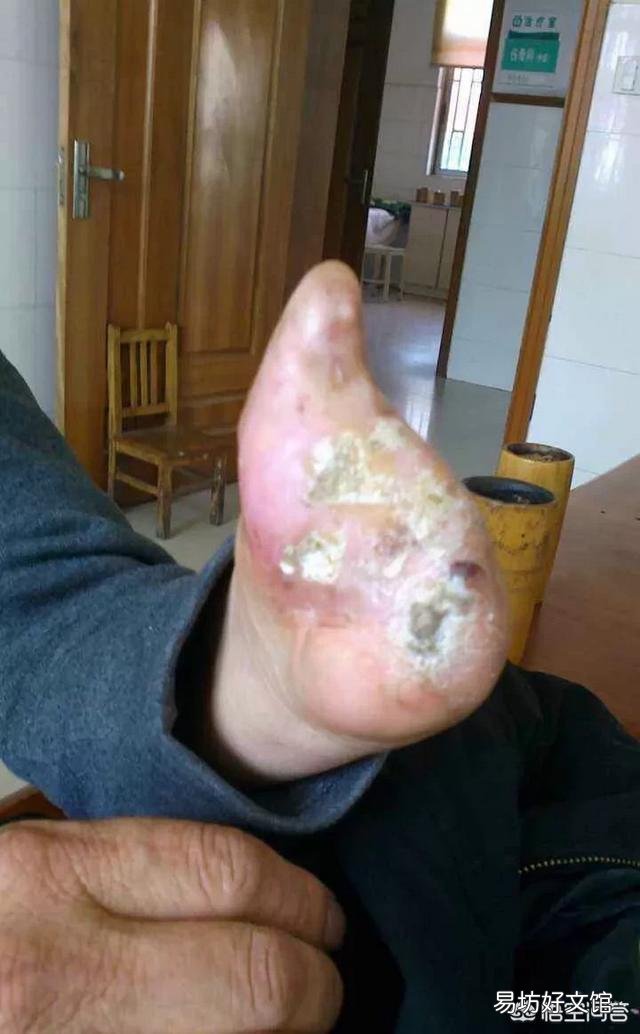 农民说农村山上的五步蛇抓不到猎物的话，会懒到吃自己的肉，这个是真的吗？为什么？