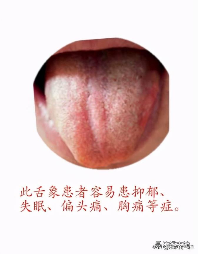 舌头上有点点是什么原因 舌头上有小红点