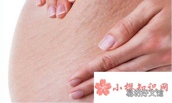 十年以上妊娠纹怎样能消除