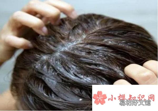 头中间为什么有头皮