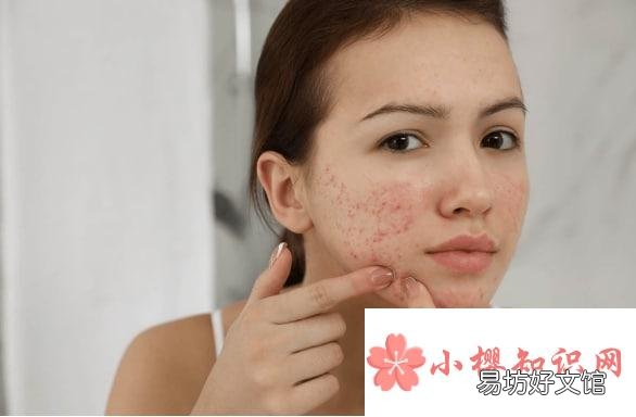 什么时候会长青春痘