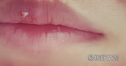 嘴唇疱疹出血能涂药吗 疱疹破了还能抹药吗