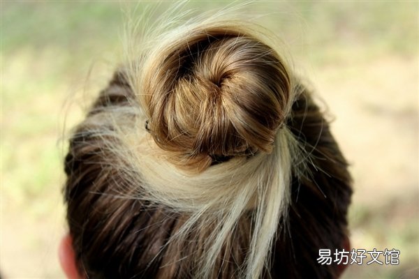 女孩薅头发吃下胃里取出5斤毛球 医生科普：异食癖多年导致