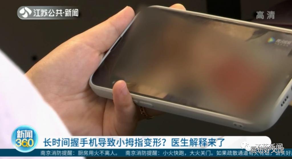 「逃过」能逃过腱鞘炎的年轻人，已经不多了