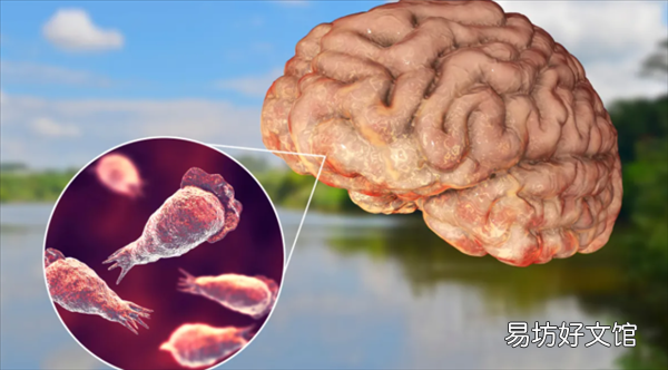 现实版三尸脑神丹?罕见食脑虫蔓延国 154人感染4人存活