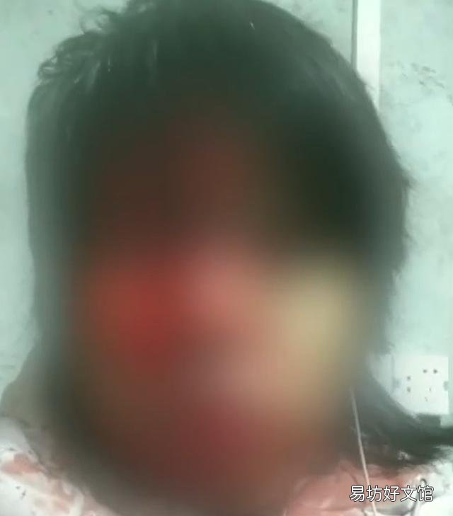 「广西」广西一听障女子被公公家暴,当地警方回应:正在调查