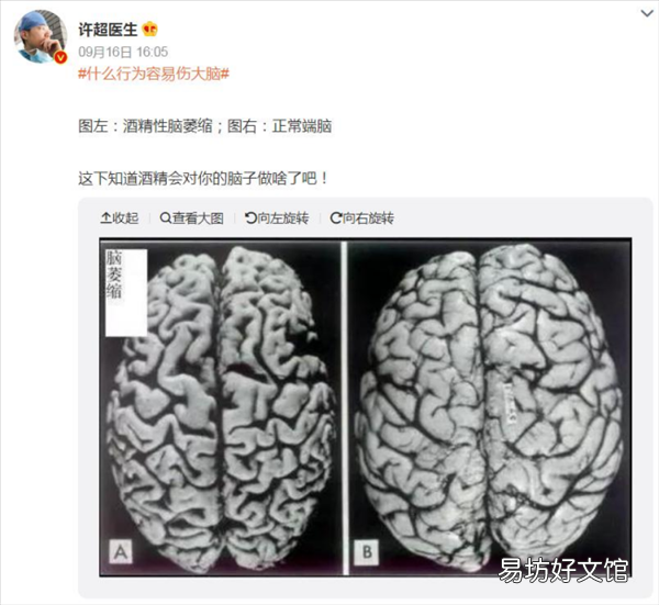 每天一杯酒 大腦會(huì)全面萎縮！6招教你保持大腦健康